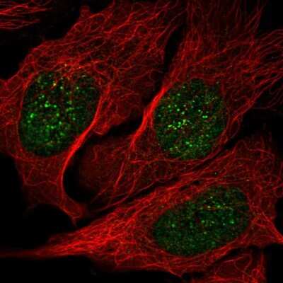 Immunocytochemistry/ Immunofluorescence NME3 Antibody - BSA Free