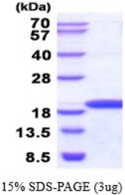 SDS-PAGE Recombinant Human NME3 His Protein