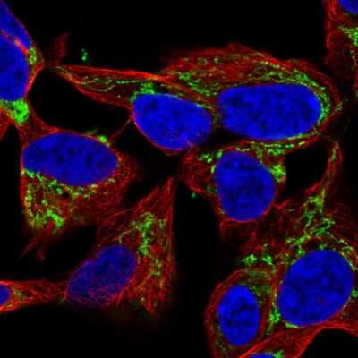 Immunocytochemistry/ Immunofluorescence NME4 Antibody