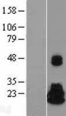 Western Blot: NME4 Overexpression Lysate (Adult Normal) [NBL1-13686] Left-Empty vector transfected control cell lysate (HEK293 cell lysate); Right -Over-expression Lysate for NME4.