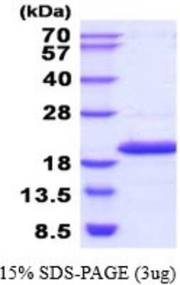 SDS-Page: NME4 Recombinant Protein [NBP2-52254] - 15% SDS Page (3 ug)