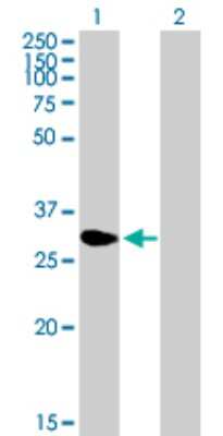 Western Blot: NME5 Antibody [H00008382-B01P] - Analysis of NME5 expression in transfected 293T cell line by NME5 polyclonal antibody.  Lane 1: NME5 transfected lysate(23.32 KDa). Lane 2: Non-transfected lysate.