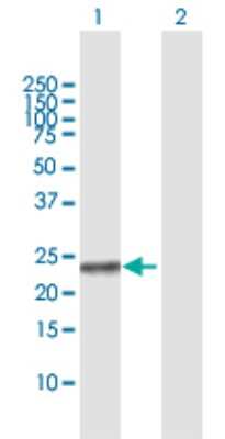 Western Blot: NME5 Antibody [H00008382-D01P] - Analysis of NME5 expression in transfected 293T cell line by NME5 polyclonal antibody.Lane 1: NME5 transfected lysate(24.20 KDa).Lane 2: Non-transfected lysate.