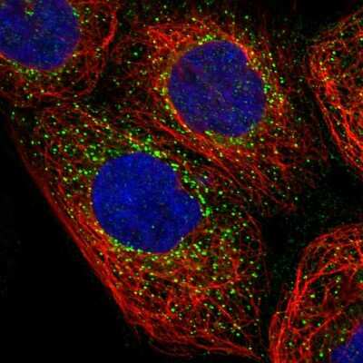 Immunocytochemistry/ Immunofluorescence NME6 Antibody