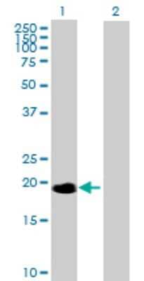 Western Blot: NME6 Antibody [H00010201-B02P] - Analysis of NME6 expression in transfected 293T cell line by NME6 polyclonal antibody.  Lane 1: NME6 transfected lysate(21.34 KDa). Lane 2: Non-transfected lysate.