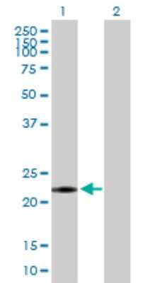 Western Blot: NME6 Antibody [H00010201-B03P] - Analysis of NME6 expression in transfected 293T cell line. Lane 1: NME6 transfected lysate (21.34 KDa). Lane 2: Non-transfected lysate.