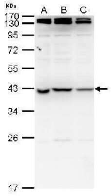 Western Blot: NME7 Antibody [NBP2-42888] - Analysis of  nucleoside diphosphate kinase 7 by nucleoside diphosphate kinase 7 antibody:   A. 20 ug human embryonic stem cell whole cell lysate/extract B. 20 ug whole cell lysate/extract of human LUC shRNA-transfected human embryonic stem cells C. 20 ug whole cell lysate/extract of human Nme7-1 shRNA-transfected human embryonic stem cells 10 % SDS-PAGE