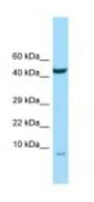 Western Blot: NMES1 Antibody [NBP1-98391] - PANC1 Cell Lysate. Antiboyd at 1.0 ug/mL, Gel Concentration: 10-20%.