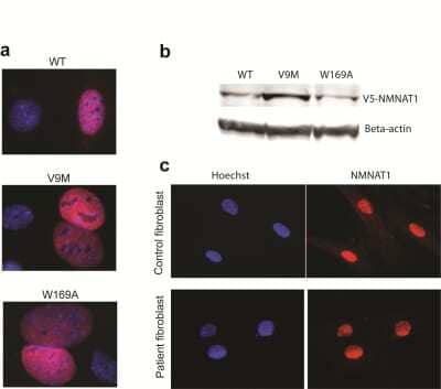 Immunocytochemistry/ Immunofluorescence NMNAT-1 Antibody