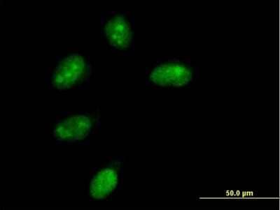 Immunocytochemistry/ Immunofluorescence NMNAT-1 Antibody