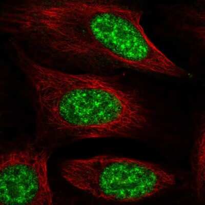 Immunocytochemistry/Immunofluorescence: NMNAT-1 Antibody [NBP2-32464] - Staining of human cell line U-2 OS shows localization to nucleoplasm & nuclear bodies.