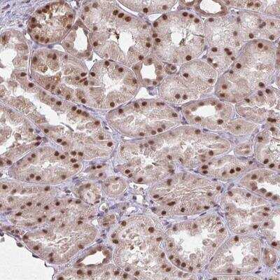 Immunohistochemistry-Paraffin: NMNAT-1 Antibody [NBP2-32464] - Staining of human kidney shows strong nuclear positivity in cells in tubules.