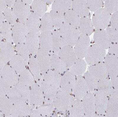 Immunohistochemistry-Paraffin: NMNAT-1 Antibody [NBP2-32464] - Staining of human skeletal muscle shows weak nuclear positivity in myocytes.