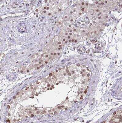 Immunohistochemistry-Paraffin: NMNAT-1 Antibody [NBP2-32464] - Staining of human testis shows moderate nuclear positivity in cells in seminiferious ducts.