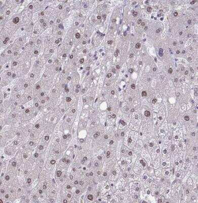 Immunohistochemistry-Paraffin: NMNAT-1 Antibody [NBP2-32464] - Staining of human liver shows moderate nuclear positivity in hepatocytes.