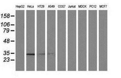Western Blot: NMNAT-1 Antibody (OTI1G4) - Azide and BSA Free [NBP2-73017] - Analysis of extracts (35ug) from 9 different cell lines by using anti-Nmnat1 monoclonal antibody.