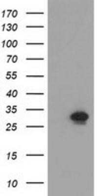 Western Blot: NMNAT-1 Antibody (OTI1G4) - Azide and BSA Free [NBP2-73017] - HEK293T cells were transfected with the pCMV6-ENTRY control (Left lane) or pCMV6-ENTRY Nmnat1 (Right lane) cDNA for 48 hrs and lysed. Equivalent amounts of cell lysates (5 ug per lane) were separated by SDS-PAGE and immunoblotted with anti-Nmnat1.