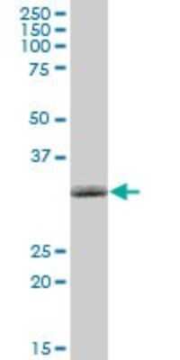 Western Blot: NMNAT-1 Antibody [H00064802-B01P] - Analysis of NMNAT1 expression in human placenta.