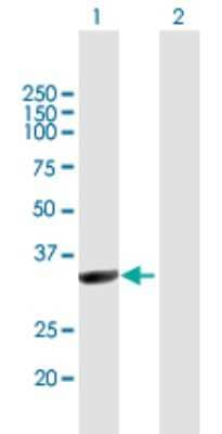 Western Blot NMNAT-1 Antibody