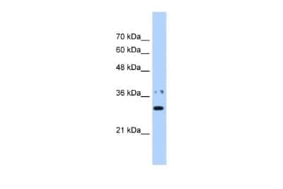 Western Blot: NMNAT-1 Antibody [NBP1-52973] - Reccomended Titration: 0.25 ug/ml Positive Control: HepG2 cell lysate