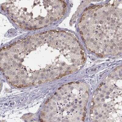 <b>Orthogonal Strategies Validation. </b>Immunohistochemistry-Paraffin: NMNAT-2 Antibody [NBP2-62637] - Staining of human testis shows high expression.