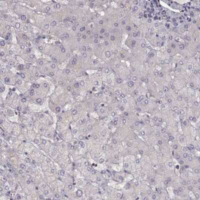 Immunohistochemistry-Paraffin: NMNAT-2 Antibody [NBP2-62637] - Staining of human liver shows low expression as expected.