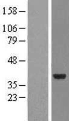 Western Blot NMNAT-2 Overexpression Lysate