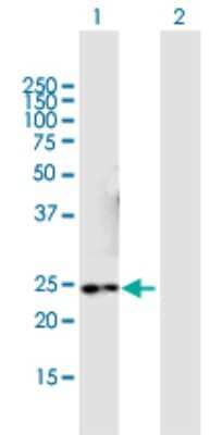 Western Blot: NMNAT3 Antibody [H00349565-B01P] - Analysis of NMNAT3 expression in transfected 293T cell line by NMNAT3 polyclonal antibody.  Lane 1: NMNAT3 transfected lysate(23.65 KDa). Lane 2: Non-transfected lysate.