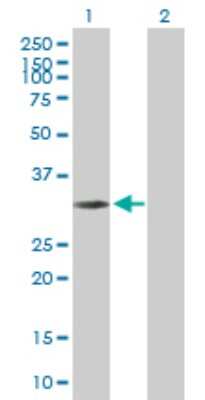 Western Blot: NMRAL1 Antibody [H00057407-B01P] - Analysis of NMRAL1 expression in transfected 293T cell line by NMRAL1 polyclonal antibody.  Lane 1: HSCARG transfected lysate(32.89 KDa). Lane 2: Non-transfected lysate.