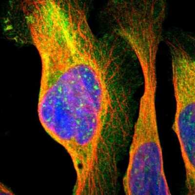 <b>Genetic Strategies Validation. </b>Immunocytochemistry/Immunofluorescence: NMT2 Antibody [NBP1-85817] - Staining of human cell line U-2 OS shows localization to plasma membrane, cytosol & the Golgi apparatus. Antibody staining is shown in green.