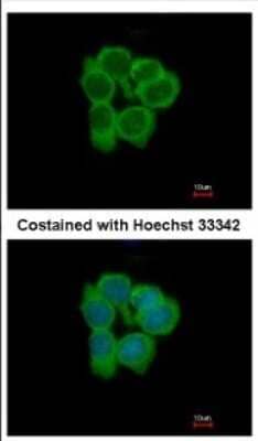 Immunocytochemistry/Immunofluorescence: NMT2 Antibody [NBP2-19555] - Immunofluorescence analysis of methanol-fixed A431, using antibody at 1:500 dilution.