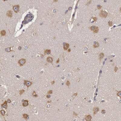 Immunohistochemistry-Paraffin: NMT2 Antibody [NBP1-85817] - Staining of human Cerebral cortex shows moderate cytoplasmic positivity in neuronal cells.