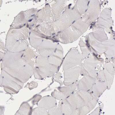 Immunohistochemistry-Paraffin: NMT2 Antibody [NBP1-85817] - Staining of human Skeletal muscle shows very weak cytoplasmic positivity in myocytes.