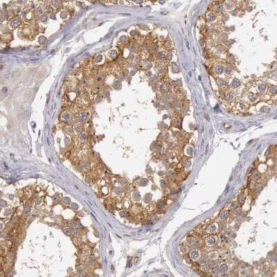 Immunohistochemistry-Paraffin: NMT2 Antibody [NBP1-85817] - Staining of human Testis shows strong membranous and cytoplasmic positivity in cells in seminiferous ducts.