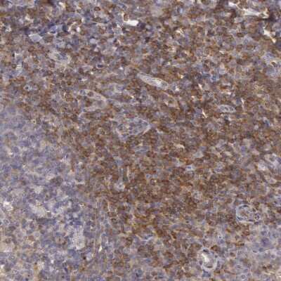 Immunohistochemistry-Paraffin: NMT2 Antibody [NBP1-85817] - Staining of human Tonsil shows moderate membranous positivity in non-germinal center cells.