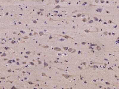 Immunohistochemistry-Paraffin: NMT2 Antibody [NBP2-97228] - Immunochemical staining of human NMT2 in human brain with rabbit polyclonal antibody at 1:100 dilution, formalin-fixed paraffin embedded sections.