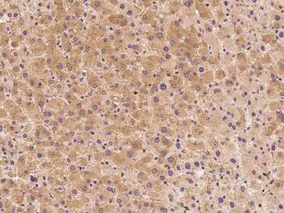 Immunohistochemistry-Paraffin: NMT2 Antibody [NBP2-99170] - Immunochemical staining NMT2 in human liver with rabbit polyclonal antibody at 1:300 dilution, formalin-fixed paraffin embedded sections.