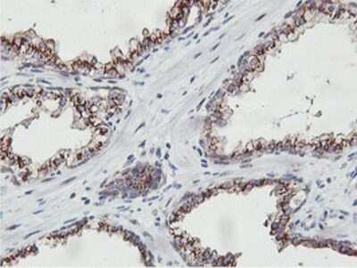 Immunohistochemistry: NMT2 Antibody (OTI1G3) - Azide and BSA Free [NBP2-73021] - Staining of paraffin-embedded Carcinoma of Human prostate tissue using anti-NMT2 mouse monoclonal antibody.