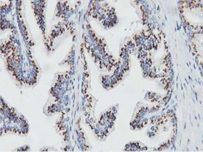 Immunohistochemistry: NMT2 Antibody (OTI1G3) - Azide and BSA Free [NBP2-73021] - Staining of paraffin-embedded Human prostate tissue using anti-NMT2 mouse monoclonal antibody.