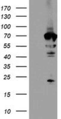 Western Blot: NMT2 Antibody (OTI1G3) - Azide and BSA Free [NBP2-73021] - HEK293T cells were transfected with the pCMV6-ENTRY control (Left lane) or pCMV6-ENTRY NMT2 (Right lane) cDNA for 48 hrs and lysed. Equivalent amounts of cell lysates (5 ug per lane) were separated by SDS-PAGE and immunoblotted with anti-NMT2.