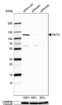 Western Blot: NMT2 Antibody [NBP1-85817] - Analysis in U2OS cells transfected with control siRNA, target specific siRNA probe #1 and #2,. Remaining relative intensity is presented. Loading control: Anti-GAPDH.