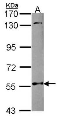 Western Blot: NMT2 Antibody [NBP2-19555] - Sample (30 ug of whole cell lysate) A: Raji 7. 5% SDS PAGE gel, diluted at 1:1000.