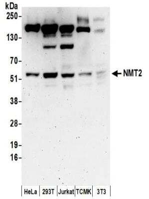 Western Blot: NMT2 Antibody [NBP2-32244] - Samples:  Whole cell lysate (50 ug) prepared using NETN buffer from HeLa, 293T, Jurkat, mouse TCMK-1, and mouse NIH3T3 cells.   Antibodies:  Affinity purified rabbit anti-NMT2 antibody NBP2-32244 used for WB at 0.1 ug/ml.  Detection: Chemiluminescence with an exposure time of 3 minutes.