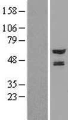 Western Blot: NMT2 Overexpression Lysate (Adult Normal) [NBL1-13695] Left-Empty vector transfected control cell lysate (HEK293 cell lysate); Right -Over-expression Lysate for NMT2.