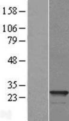 Western Blot: PMF1 Overexpression Lysate [NBL1-14535] - Left-Empty vector transfected control cell lysate (HEK293 cell lysate); Right -Over-expression Lysate for NNF1R.