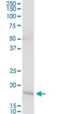 Western Blot: NNT Antibody [H00023530-D01P] - Analysis of NNT expression in human kidney.