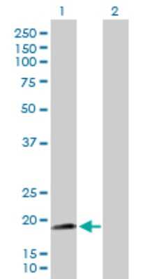 Western Blot: NNT Antibody [H00023530-D01P] - Analysis of NNT expression in transfected 293T cell line by NNT polyclonal antibody.Lane 1: NNT transfected lysate(22.30 KDa).Lane 2: Non-transfected lysate.