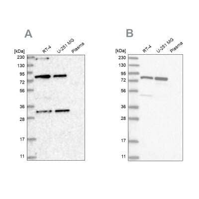 Western Blot: NOA1 Antibody [NBP1-81772] - Analysis using Anti-NOA1 antibody NBP1-81772 (A) shows similar pattern to independent antibody NBP1-81773 (B).