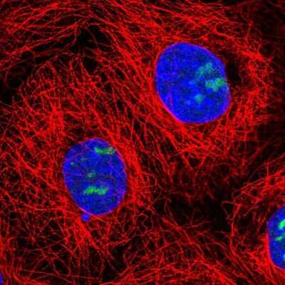 Immunocytochemistry/Immunofluorescence: NOC3L Antibody [NBP2-56518] - Staining of human cell line A-431 shows localization to nucleoli.