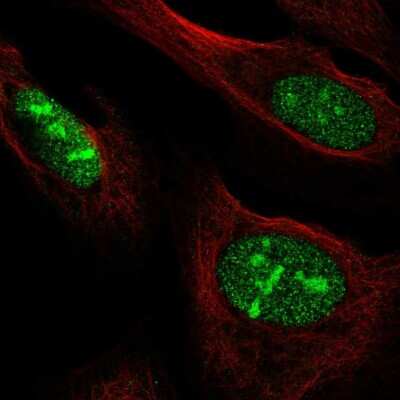 Immunocytochemistry/Immunofluorescence: NOC3L Antibody [NBP2-58021] - Staining of human cell line U-2 OS shows localization to nucleus & nucleoli.